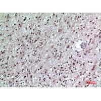 CD84 Polyclonal Antibody