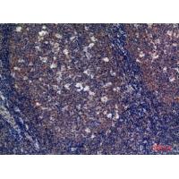CD89 Polyclonal Antibody