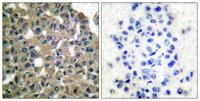 MAGE-1 Polyclonal Antibody