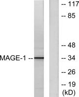 MAGE-1 Polyclonal Antibody