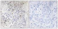 MafF Polyclonal Antibody