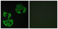 MADD Polyclonal Antibody