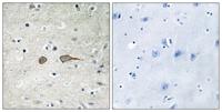 MADD Polyclonal Antibody