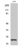 MAD2 Polyclonal Antibody