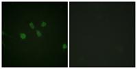 MAD1 Polyclonal Antibody