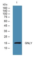 GNLY Polyclonal Antibody