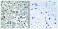 GNPAT Polyclonal Antibody