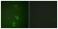 ROM-K Polyclonal Antibody