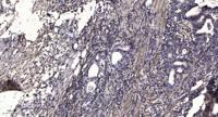 ROM-K Polyclonal Antibody