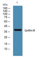 GnRH-R Polyclonal Antibody