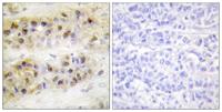 RORα Polyclonal Antibody