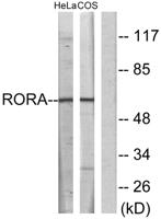 RORα Polyclonal Antibody