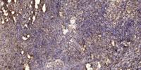 RORγ Polyclonal Antibody