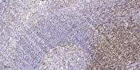 LZK Polyclonal Antibody