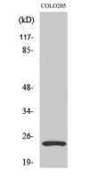 LYPLA1 Polyclonal Antibody