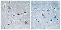 LYPLA1 Polyclonal Antibody