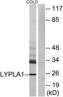 LYPLA1 Polyclonal Antibody