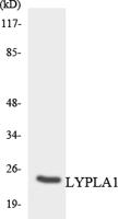 LYPLA1 Polyclonal Antibody