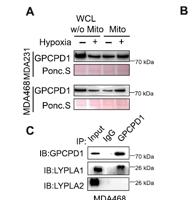 LYPA2 Polyclonal Antibody