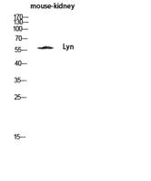 Lyn Polyclonal Antibody