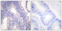 Lyn Polyclonal Antibody