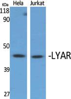 LYAR Polyclonal Antibody