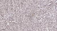 LYAR Polyclonal Antibody