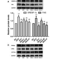 LXRα Polyclonal Antibody