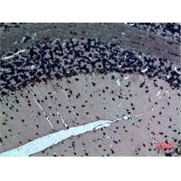 LXRα Polyclonal Antibody