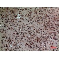 LXRα Polyclonal Antibody