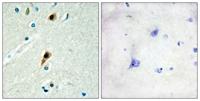 LUCA15 Polyclonal Antibody