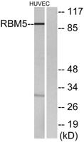 LUCA15 Polyclonal Antibody