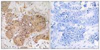LUC7L2 Polyclonal Antibody