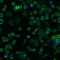LTβR Polyclonal Antibody