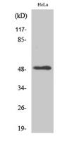 LTβR Polyclonal Antibody