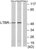 LTβR Polyclonal Antibody