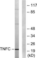 LT-β Polyclonal Antibody