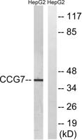 L-type Ca++ CP γ7 Polyclonal Antibody