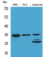 Cdc34 Polyclonal Antibody