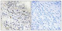 Cdc7 Polyclonal Antibody