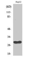 CdcA3 Polyclonal Antibody