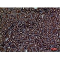 CDCP1 Polyclonal Antibody