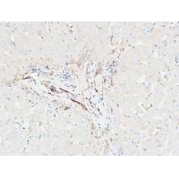 CDCP1 Polyclonal Antibody