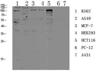 CDH17 Polyclonal Antibody