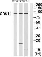 Cdk11A/B Polyclonal Antibody