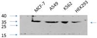 Cdk2 Polyclonal Antibody