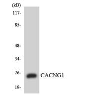 L-type Ca++ CP γ1 Polyclonal Antibody