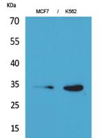 Cdk4 Polyclonal Antibody