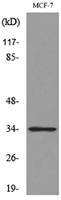 Cdk4 Polyclonal Antibody