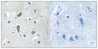 CDK5 Activator-binding C48 Polyclonal Antibody